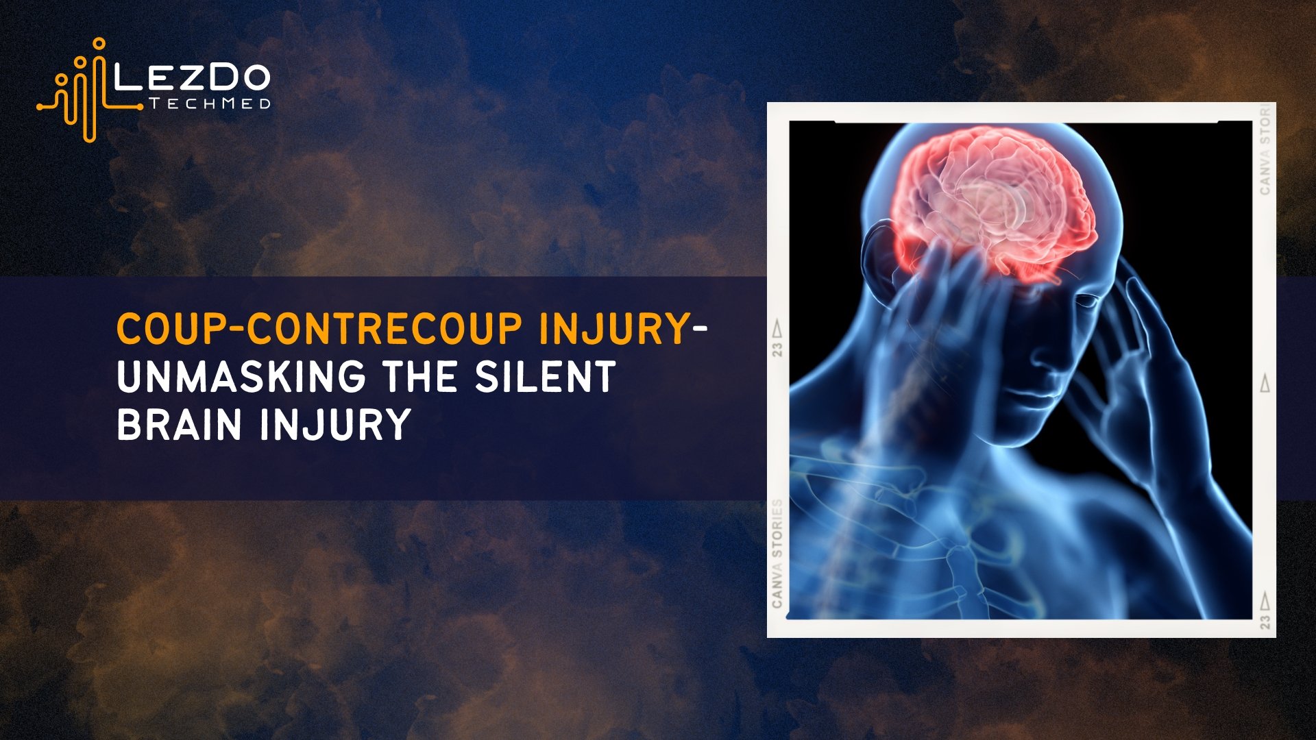 Coup Contrecoup Injury-Unmasking the Silent Brain Injury