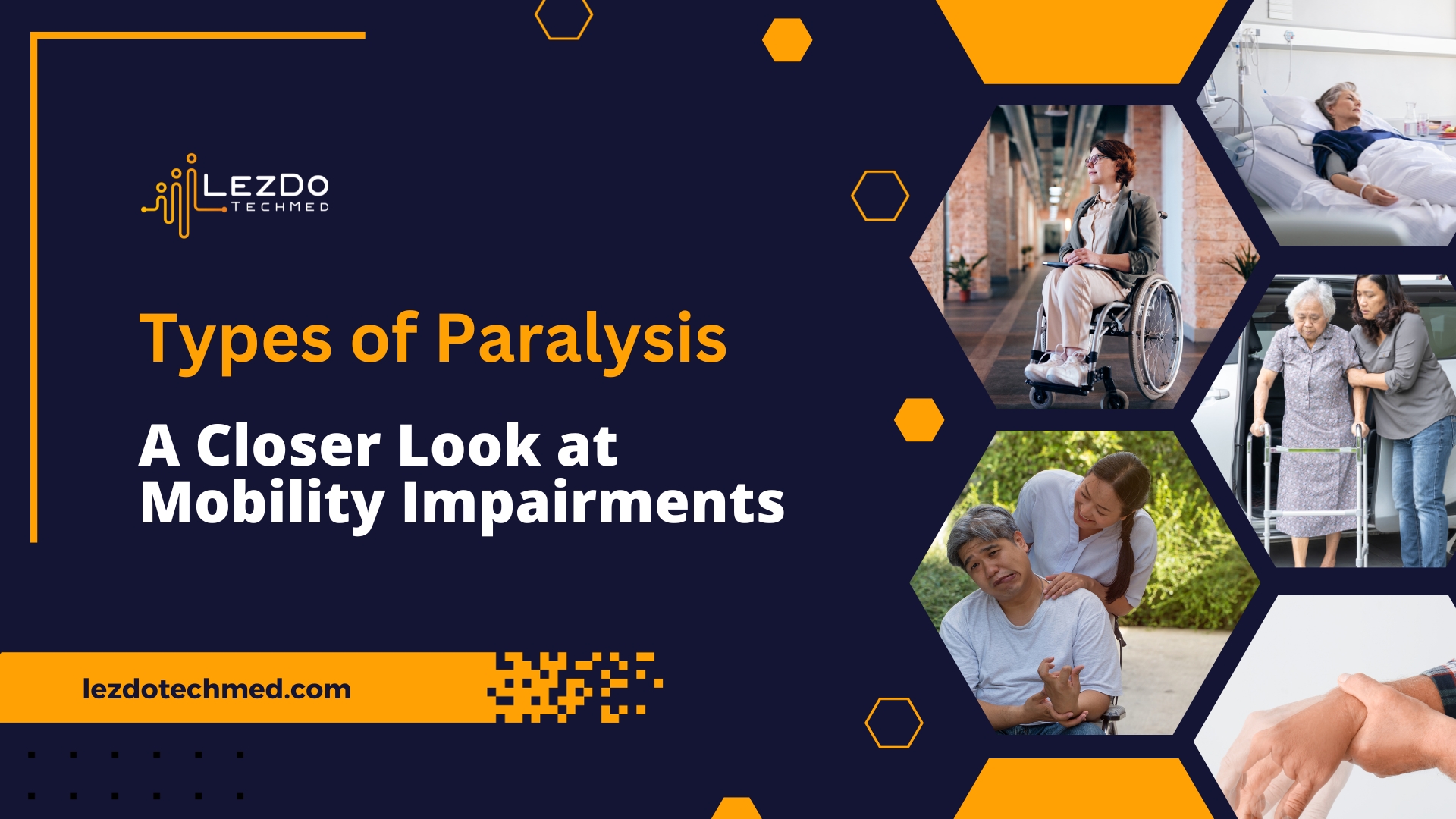 Types of Paralysis: A Closer Look at Mobility Impairments